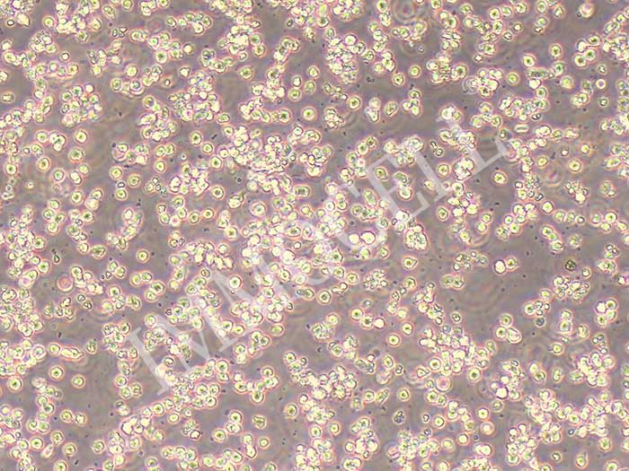 OCI-LY10人弥漫大B细胞淋巴瘤细胞（STR鉴定正确）