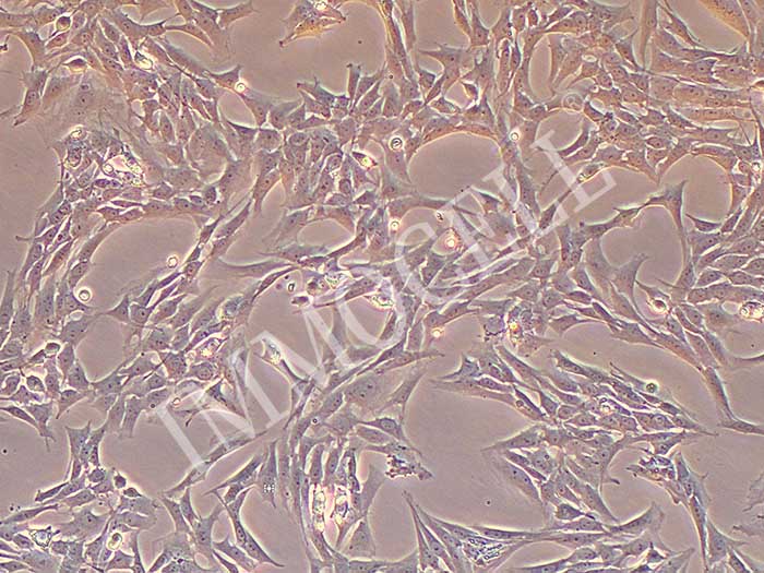 大鼠视网膜muller细胞永生化