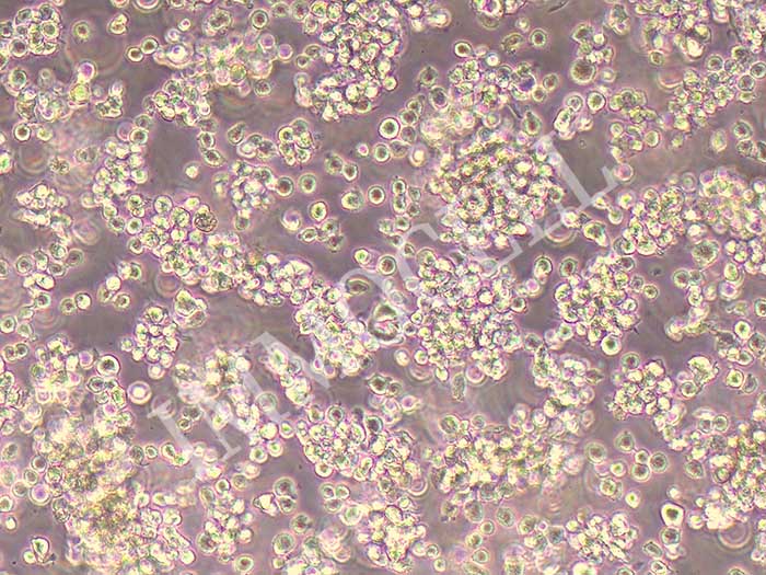 HMC-1人肥大细胞（STR鉴定正确）