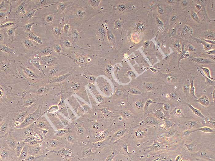 HRMEC 人视网膜微血管内皮细胞