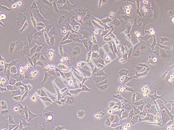 KYSE-520人食管鳞癌细胞（STR鉴定正确）
