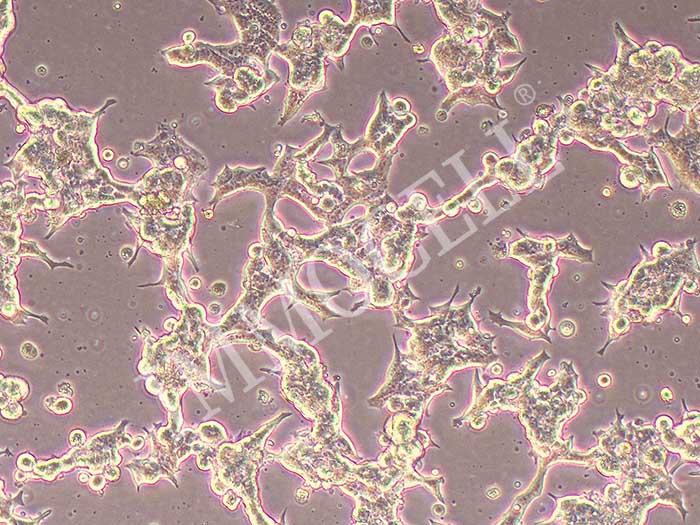 LAPC4人前列腺癌细胞