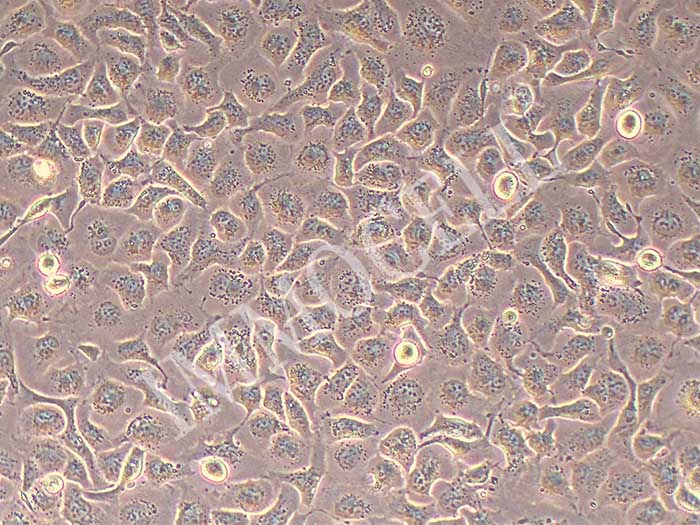NCI-H661人大细胞肺癌细胞（STR鉴定正确）