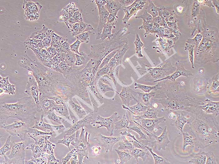 NTERA-2 cl.D1人睾丸癌细胞（STR鉴定正确）
