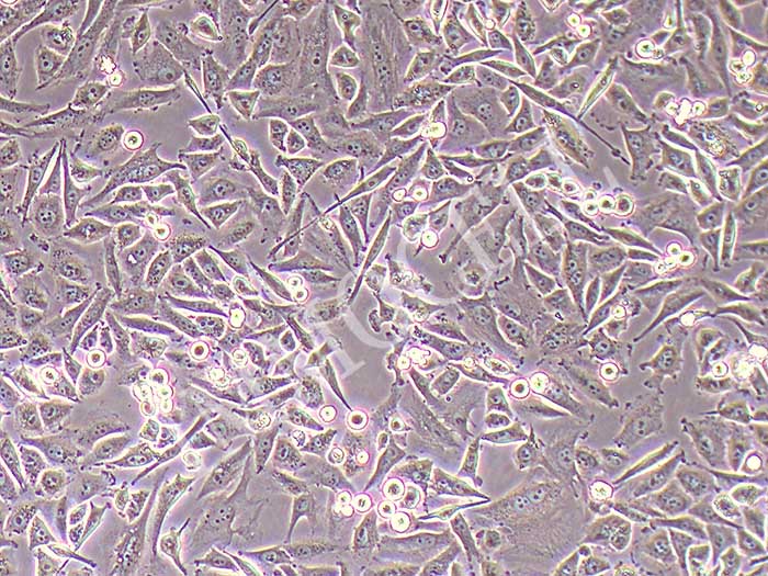 PSN1人胰腺癌细胞（STR鉴定正确）