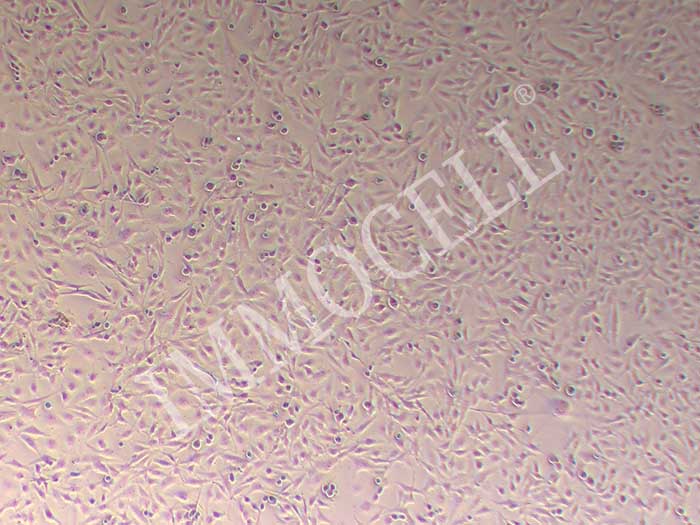 U251MG/TMZ-FLUC-puro人类星形胶质瘤耐替莫唑胺细胞(FLUC标记)