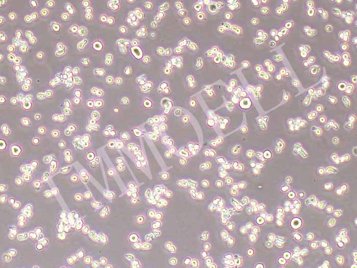 MM.1R人多发性骨髓瘤细胞（STR鉴定正确）