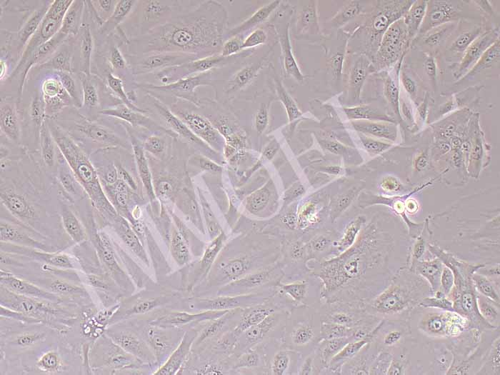 SNU-840人卵巢癌细胞系（STR鉴定正确）