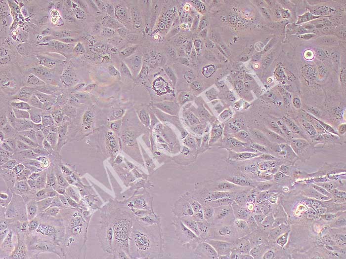 CMT64/61小鼠肺腺癌细胞（种属鉴定）