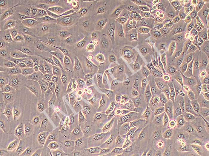 SCC-25人舌鳞癌细胞