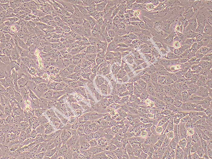 C643人甲状腺癌细胞（STR鉴定）