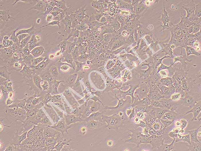 TU-138人喉癌细胞（污染细胞系）