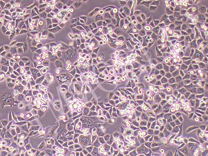 ASPC-1/GEM人转移胰腺腺癌细胞吉西他滨耐药株