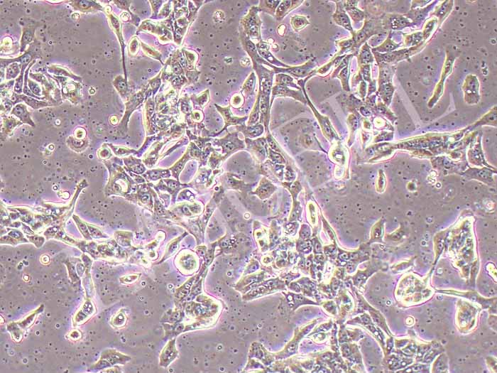 HCC70人乳腺导管癌细胞（STR鉴定正确）