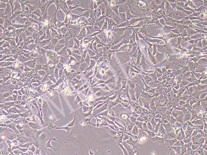 KYSE-140人食管鳞状细胞癌（STR鉴定正确）