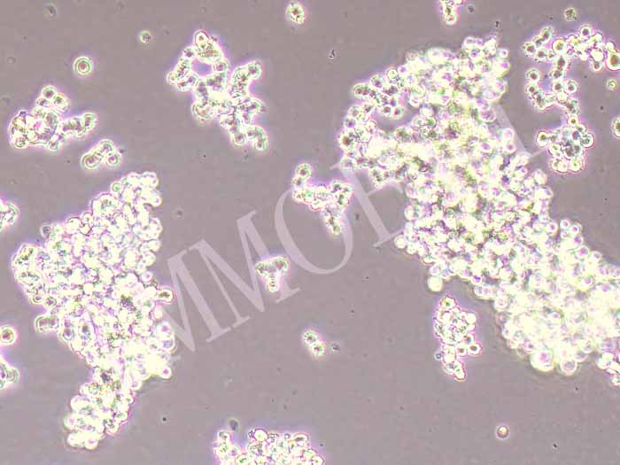 NCI-H146人小细胞肺癌细胞（STR鉴定正确）