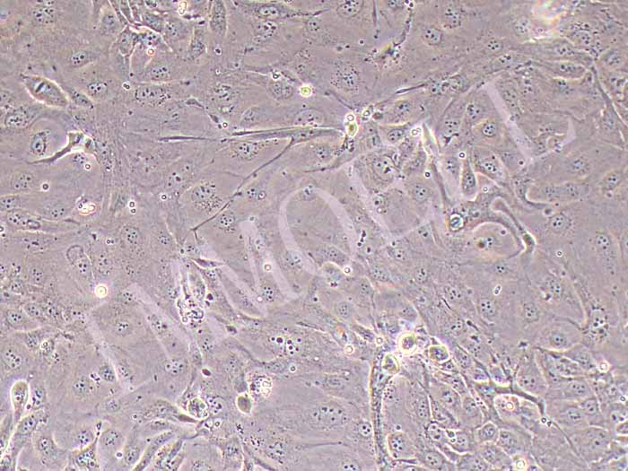 NCI-H2347人非小细胞肺癌细胞（STR鉴定正确）