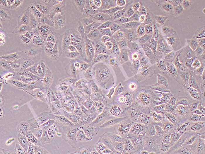 SNU878人肝癌细胞（STR鉴定正确）
