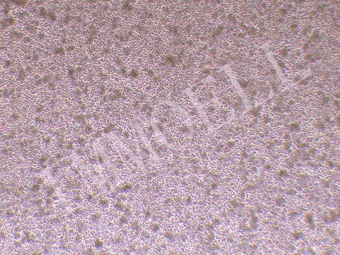 Z-138人套细胞淋巴瘤细胞（STR鉴定正确）