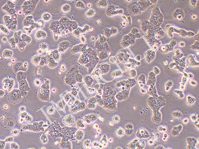 COLO678人结肠癌细胞（STR鉴定正确）