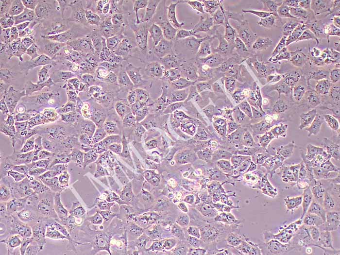NTERA-2人恶性多发性畸胎瘤细胞