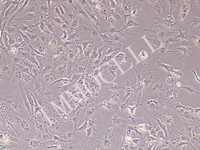 PA-1人卵巢畸胎瘤细胞（STR鉴定正确）
