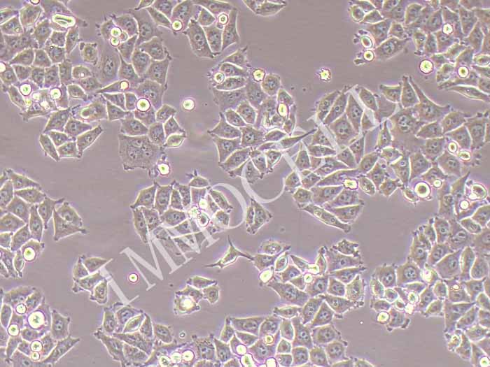SACC-LM人涎腺腺样囊性癌细胞高转移（STR鉴定正确）