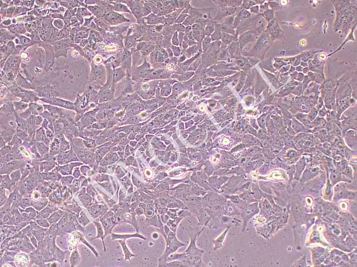 UPCI:SCC090人舌头鳞癌细胞（STR鉴定正确）