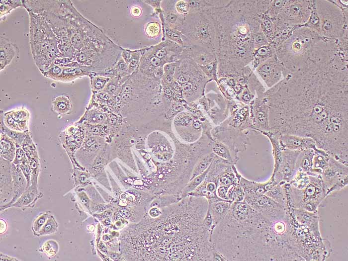 SU.86.86人胰腺导管癌细胞