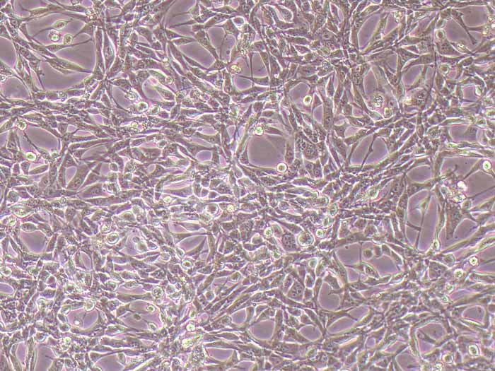 NIH/3T3小鼠胚胎成纤维细胞（STR鉴定正确）