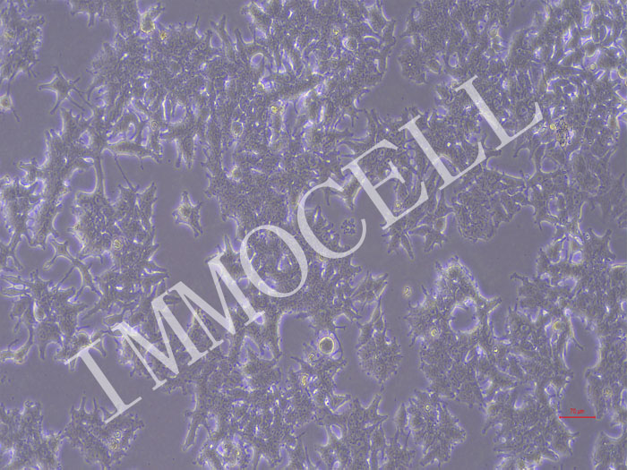 22RV1-NLUC-puro人前列腺癌细胞(NLUC标记)