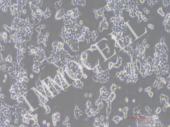 SIHA-NLUC-bsd人子宫颈鳞癌细胞(NLUC标记)
