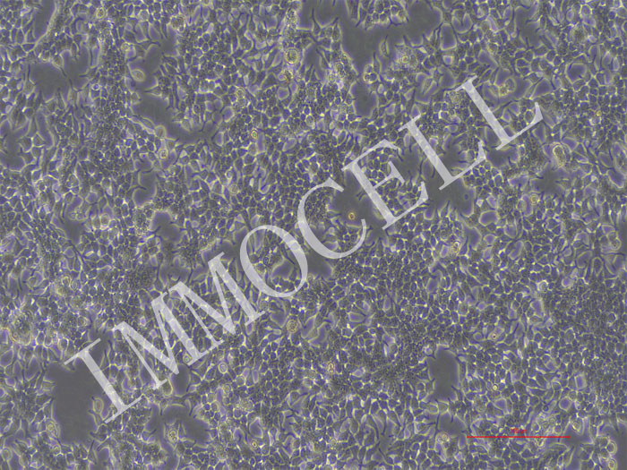 SIHA-NLUC-puro人子宫颈鳞癌细胞(NLUC标记)