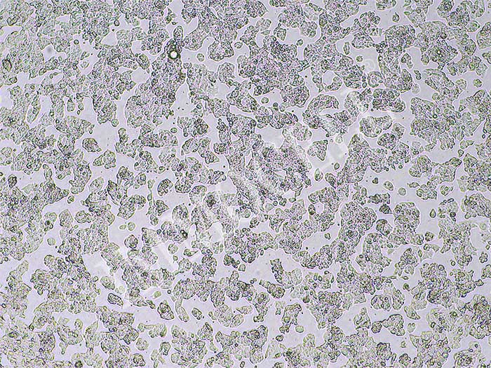 HEPG2-NTCP-puro人肝癌细胞(NTCP稳转)（STR鉴定正确）