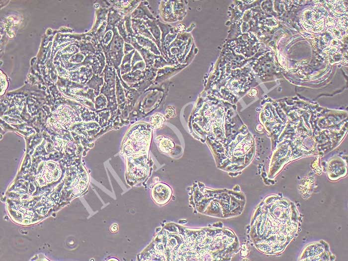 caov-4人卵巢癌细胞（STR鉴定正确）