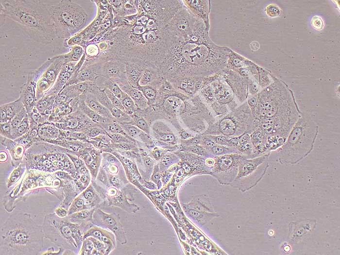HCC1171人肺癌腺癌贴壁细胞（STR鉴定正确）
