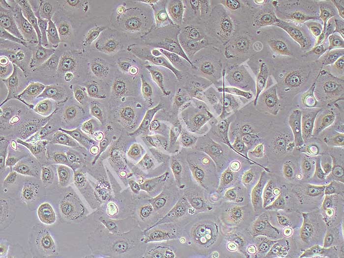 HSC-2人舌鳞癌细胞（STR鉴定正确）