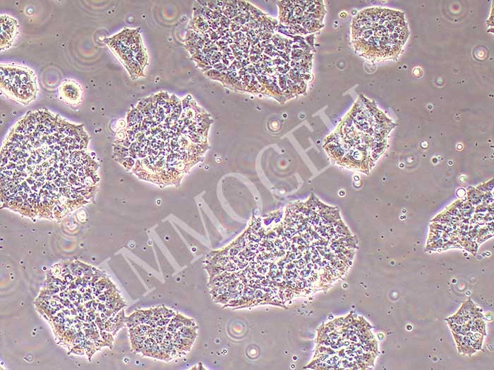 NCI-H69AR人肺癌细胞（STR鉴定正确）