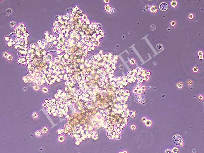 OCUM-1人胃癌细胞（STR鉴定正确）