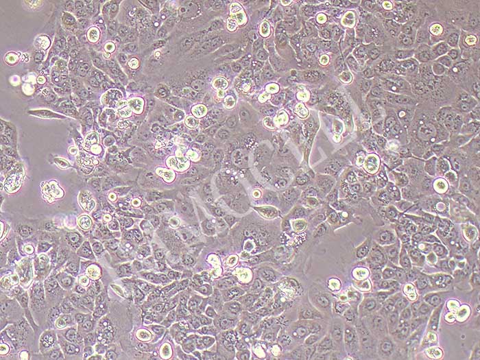 Panc08.13人胰腺癌细胞（STR鉴定正确）
