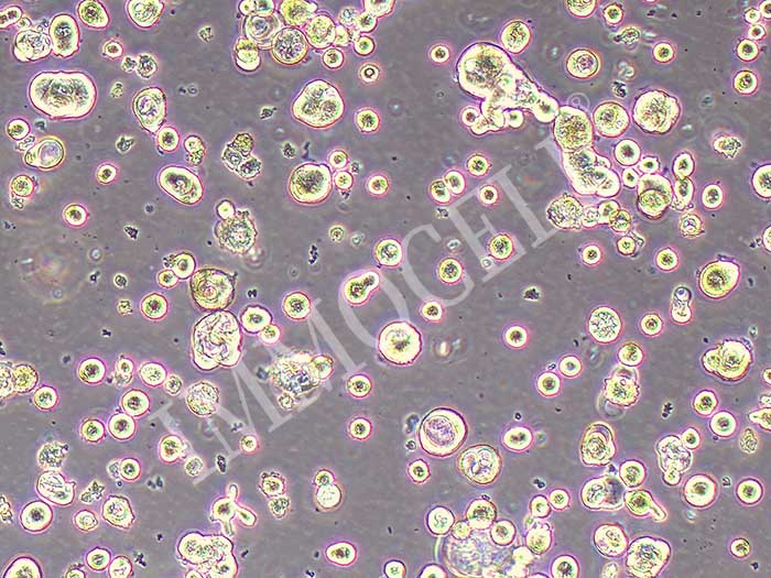 SNU-C1人结肠癌细胞（STR鉴定正确）