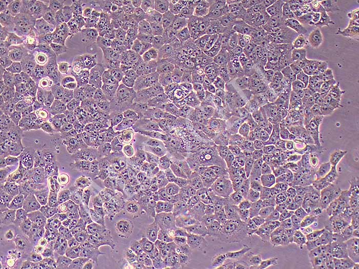 CAL-27-FLUC-puro人舌鳞癌细胞(FLUC标记)（STR鉴定正确）