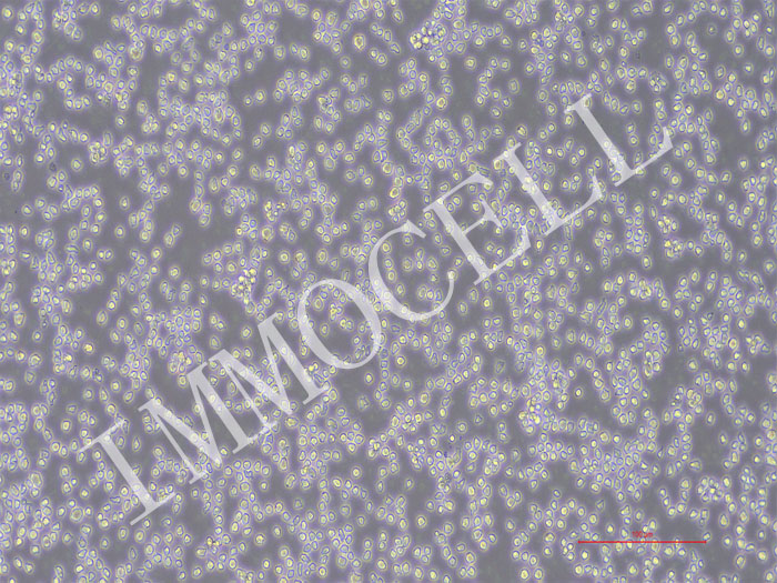 NALM-6-NLUC-bsd人B淋巴白血病细胞(NLUC标记)（STR鉴定正确）