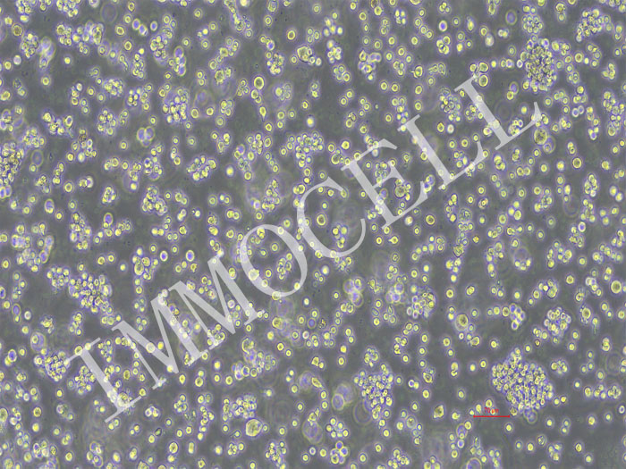 RAJI-NLUC-puro人Burkitt's淋巴瘤细胞(NLUC标记)