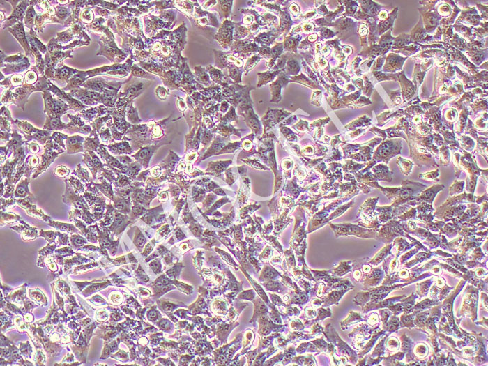 SCC7-NLUC-puro小鼠头颈鳞癌细胞(NLUC标记)（STR鉴定正确）