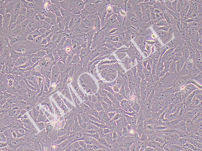 143BTK-人胸腺激酶缺陷细胞