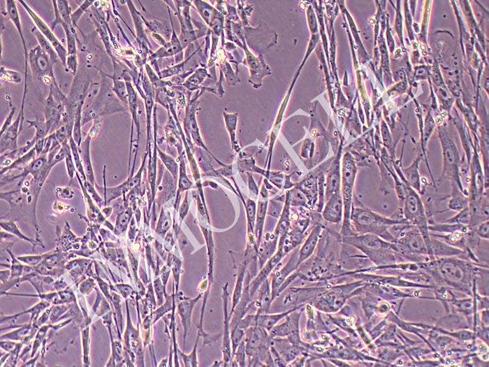 CCC-HPF-1人胚肺成纤维细胞（STR鉴定正确）