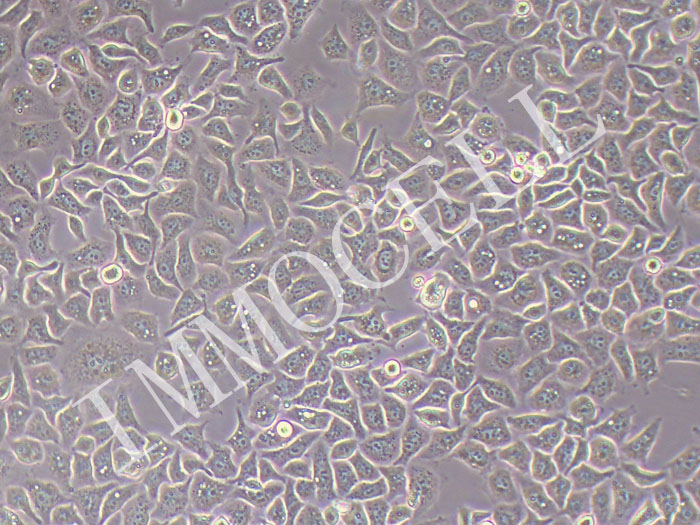 HCC1806人乳腺鳞状癌细胞（三阴性）（STR鉴定正确）