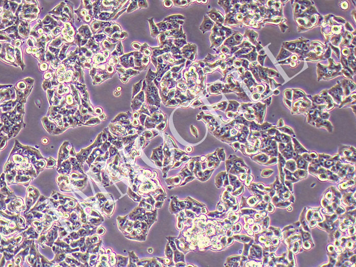 HepAD38人肝癌细胞（STR鉴定正确）