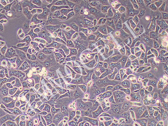 IGROV1人卵巢癌细胞（STR鉴定正确）